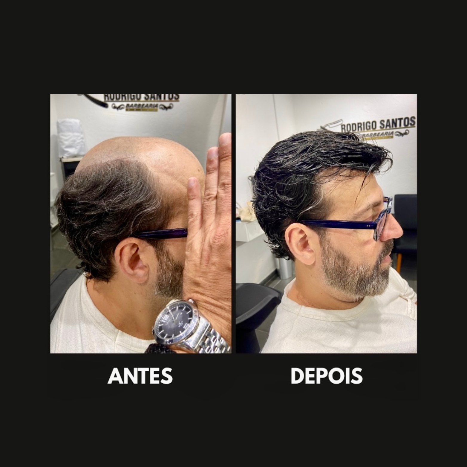 Barbearia Especializada em Prótese Capilar